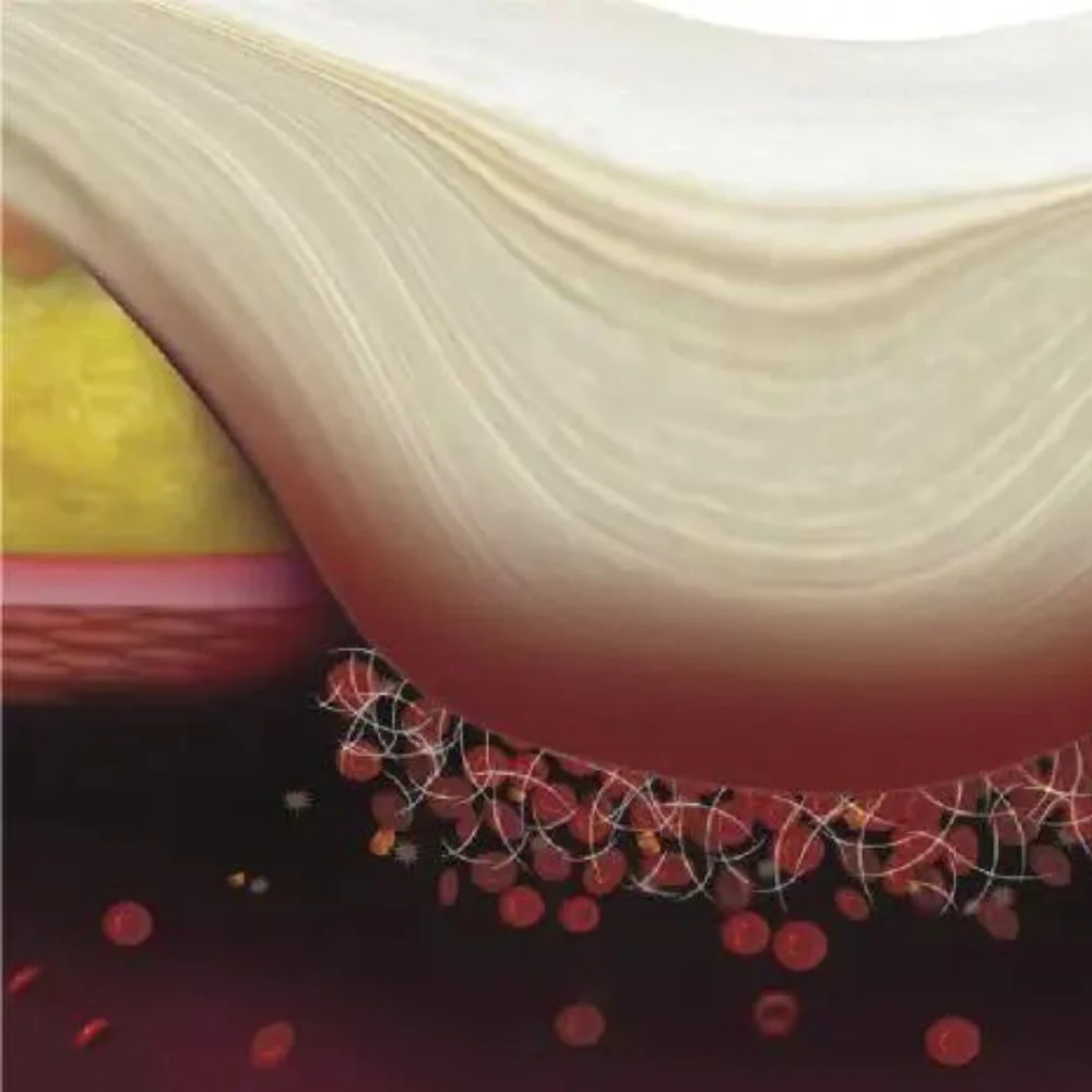 Axiostat Z-Fold Chitosan Hämostatische Wundauflage - Image 3